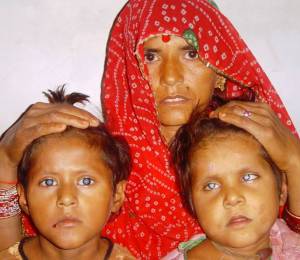 Mother with 2 blind kids