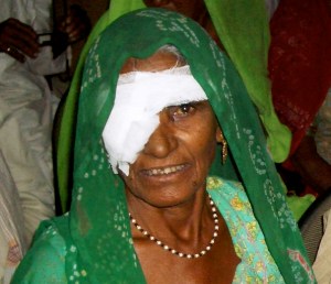 Woman in green smiling after surgery 2005-11-17 India II 740